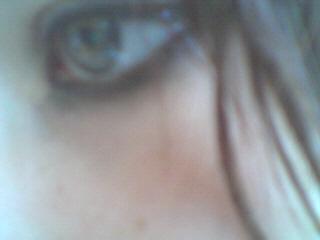 my eye